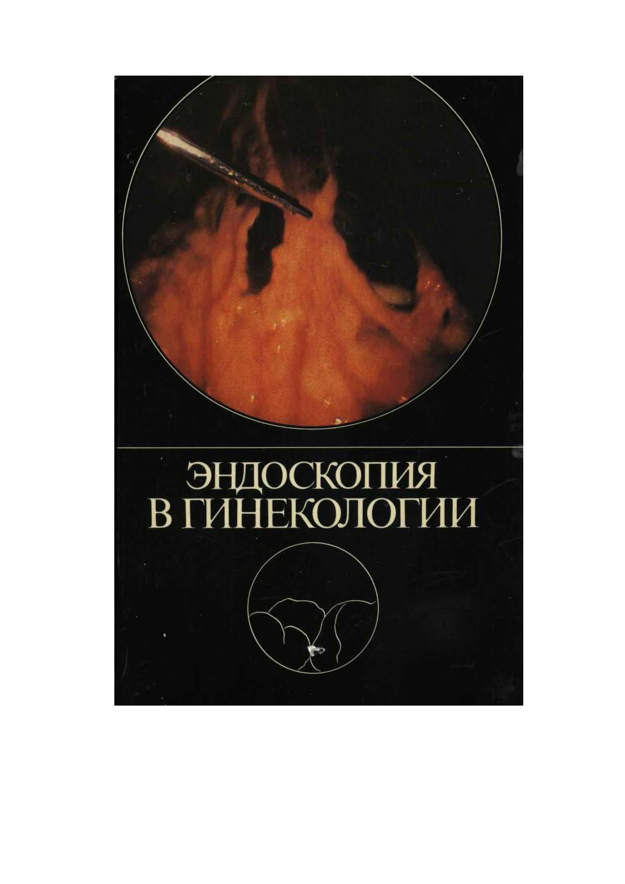 ЭНДОСКОПИЯ В ГИНЕКОЛОГИИ